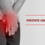 Prostate Cancer Signs
