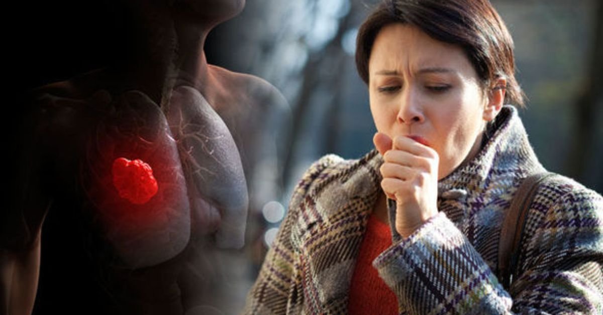 Lung Cancer Symptoms in Women