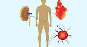 Long-Term Dangers of High Glucose