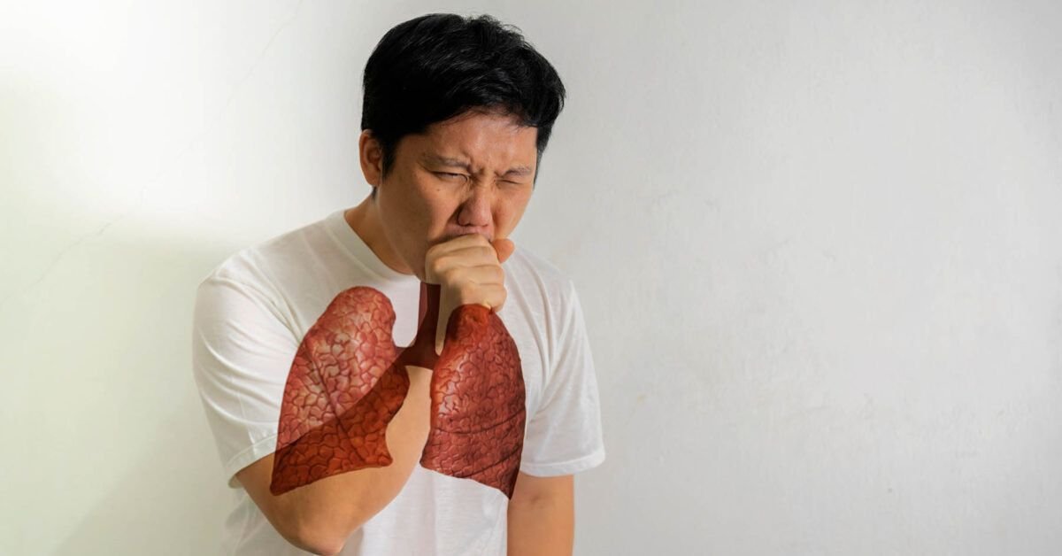 Symptoms of Lung Cancer in Men